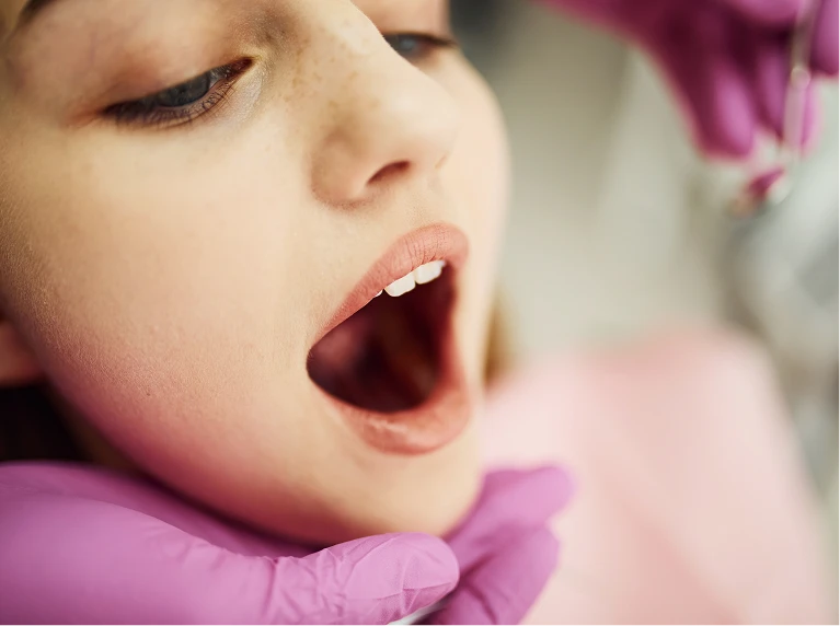 Myofunctional Therapy - C - Developmental Dentistry